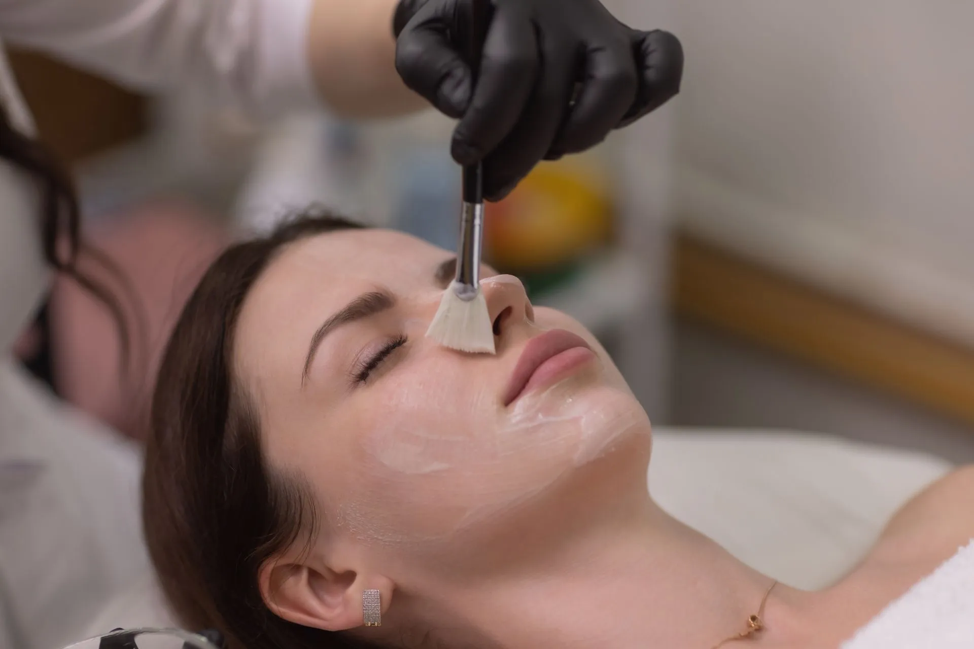 Peeling medico — Beauty Medical Lab Roma Eur