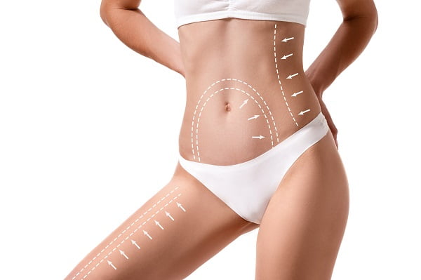 Radiofrequenza BodyTite — Beauty Medical Lab Roma Eur