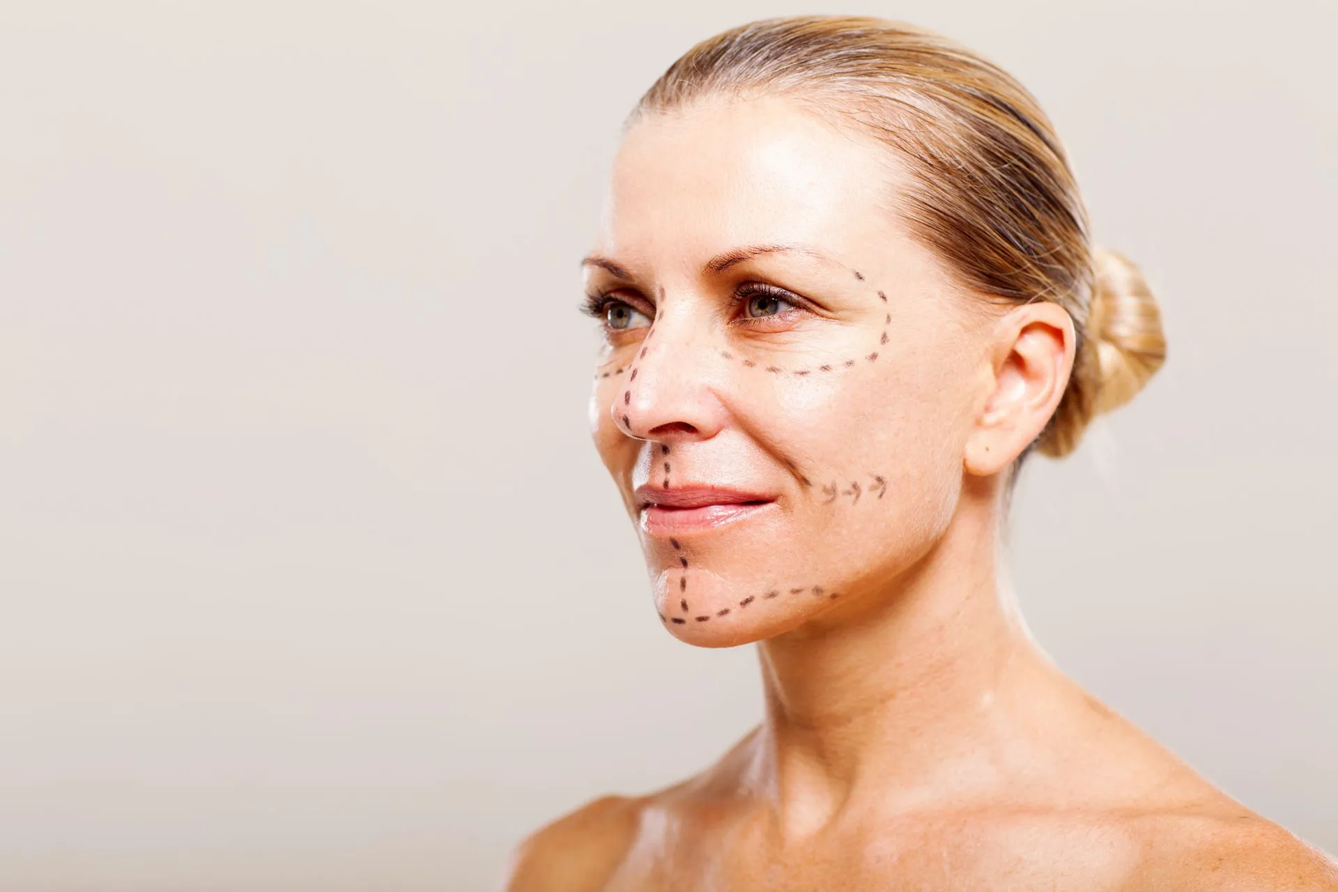 Lifting — Beauty Medical Lab Roma Eur