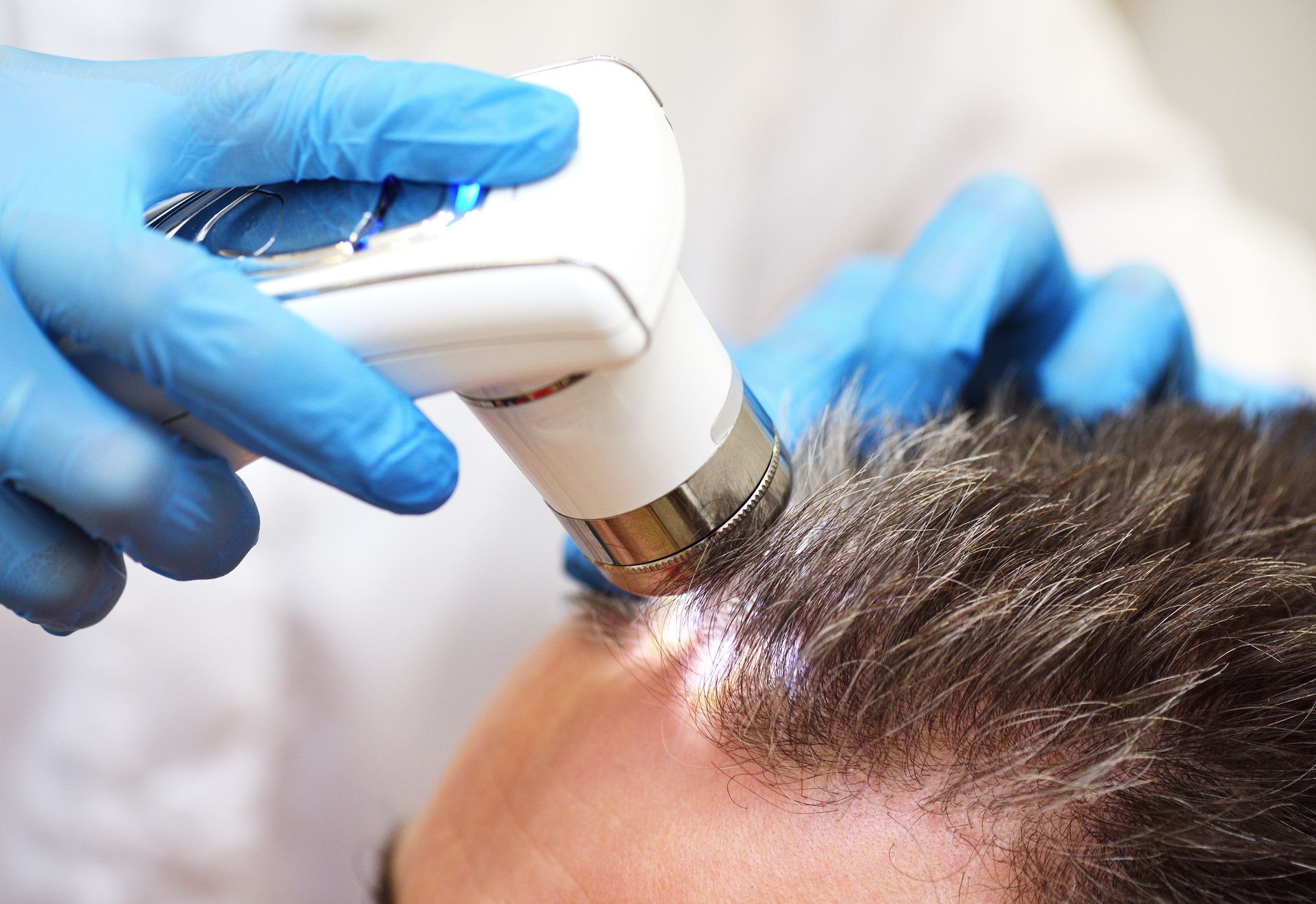 Tricologia — Beauty Medical Lab